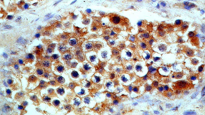 Immunohistochemical of paraffin-embedded human testis using Catalog No:109620(CSTL1-Specific antibody) at dilution of 1:50 (under 40x lens)