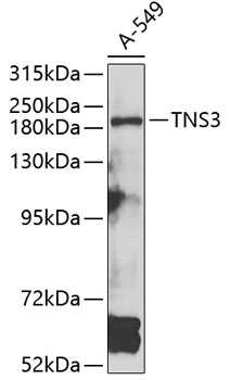 Western blot - TNS3 Polyclonal Antibody 