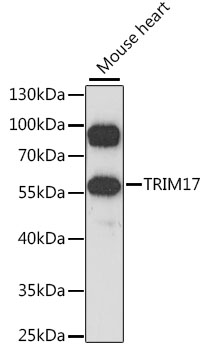 Western blot - TRIM17 Polyclonal Antibody 