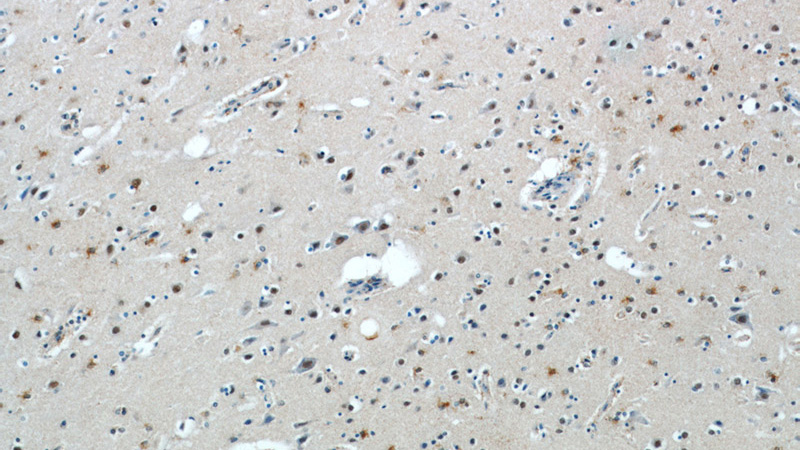 Immunohistochemical of paraffin-embedded human brain using Catalog No:108682(C1orf83 antibody) at dilution of 1:50 (under 10x lens)