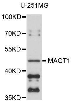 Western blot - MAGT1 Polyclonal Antibody 