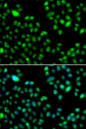 Immunofluorescence - L3MBTL3 Polyclonal Antibody 