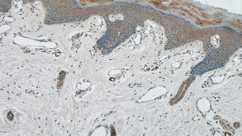 Immunohistochemical of paraffin-embedded human skin using Catalog No:116968(ZNF259 antibody) at dilution of 1:100 (under 10x lens)