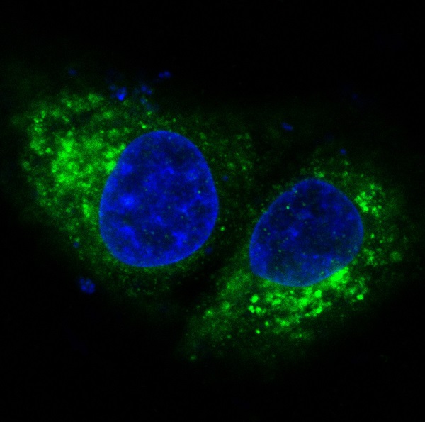 Immunofluorescent analysis of Hela cells, using Bak Antibody .
