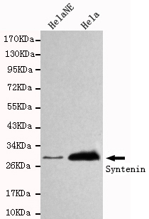 Western blot detection of Syntenin in HelaNE and Hela cell lysates using Syntenin mouse mAb (1:1000 diluted).Predicted band size:32KDa.Observed band size:32KDa.