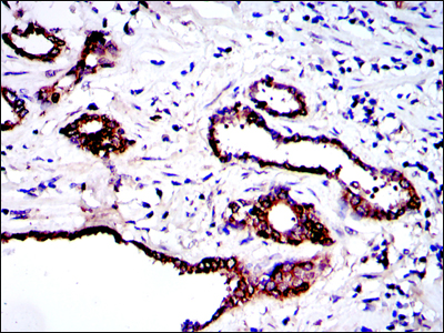 Immunohistochemical analysis of paraffin-embedded prostate tissues using PRK2 mouse mAb with DAB staining.