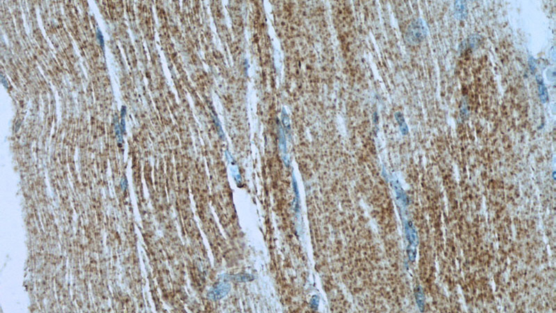 Immunohistochemistry of paraffin-embedded human skeletal muscle slide using Catalog No:111932(IRGQ Antibody) at dilution of 1:50 (under 40x lens)