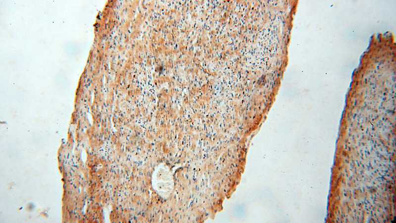 Immunohistochemical of paraffin-embedded human heart using Catalog No:109980(DIXDC1 antibody) at dilution of 1:100 (under 10x lens)