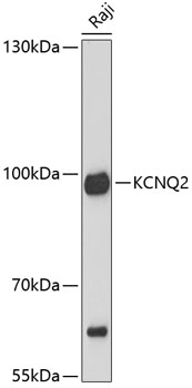 Western blot - KCNQ2 Polyclonal Antibody 