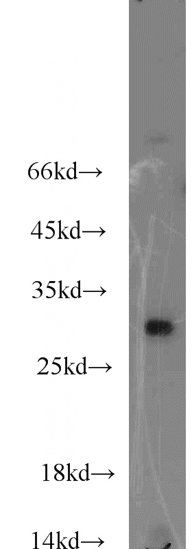 mouse kidney tissue were subjected to SDS PAGE followed by western blot with Catalog No:107811(ABHD14A antibody) at dilution of 1:300