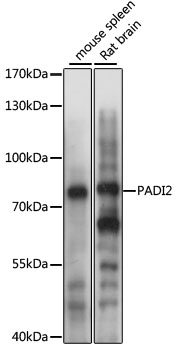 Western blot - PADI2 Polyclonal Antibody 