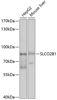 Western blot - SLCO2B1 Polyclonal Antibody 