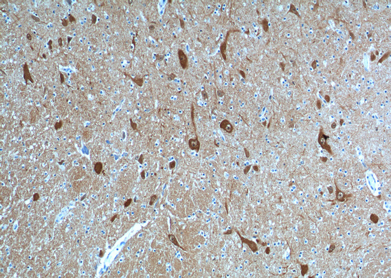 Immunohistochemistry of paraffin-embedded human hypothalamus tissue slide using Catalog No:107531(UCHL1 Antibody) at dilution of 1:500 (under 10x lens).