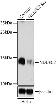 Western blot - NDUFC2 Polyclonal Antibody 