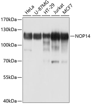 Western blot - NOP14 Polyclonal Antibody 