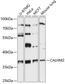 Western blot - CALHM2 Polyclonal Antibody 