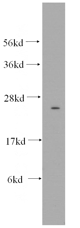 human heart tissue were subjected to SDS PAGE followed by western blot with Catalog No:109449(Connexin-26 antibody) at dilution of 1:500