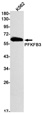 Western blot detection of PFKFB3 in K562 cell lysates using PFKFB3 Rabbit mAb(1:1000 diluted).Predicted band size:60kDa.Observed band size:60kDa.