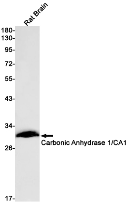 Western blot detection of Carbonic Anhydrase 1/CA1 in Rat Brain lysates using Carbonic Anhydrase 1/CA1 Rabbit pAb(1:1000 diluted).Predicted band size:29kDa.Observed band size:29kDa.