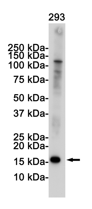 Western blot detection of CDKN2A/p16INK4a in 293 cell lysates using CDKN2A/p16INK4a Rabbit pAb(1:1000 diluted).Predicted band size:17KDa.Observed band size:17KDa.