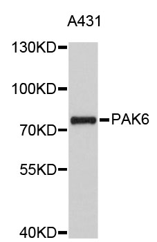 Western blot - PAK6 Polyclonal Antibody 