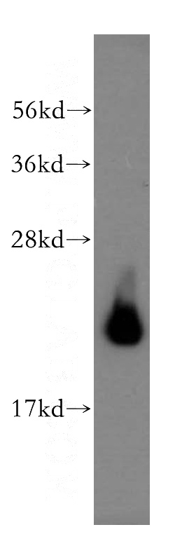 human testis tissue were subjected to SDS PAGE followed by western blot with Catalog No:108126(AP3S2 antibody) at dilution of 1:800
