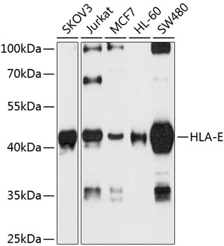Western blot - HLA-E Polyclonal Antibody 