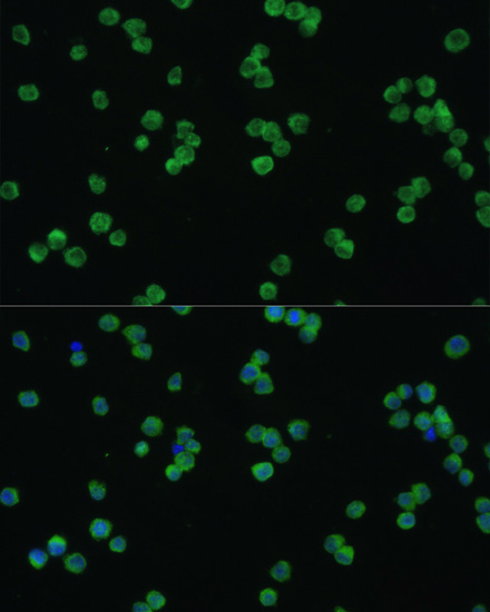 Immunofluorescence - LZTR1 Polyclonal Antibody 