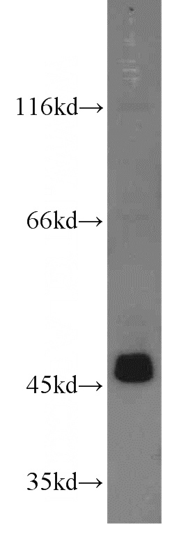 MCF7 cells were subjected to SDS PAGE followed by western blot with Catalog No:107713(ACOT9 antibody) at dilution of 1:1000
