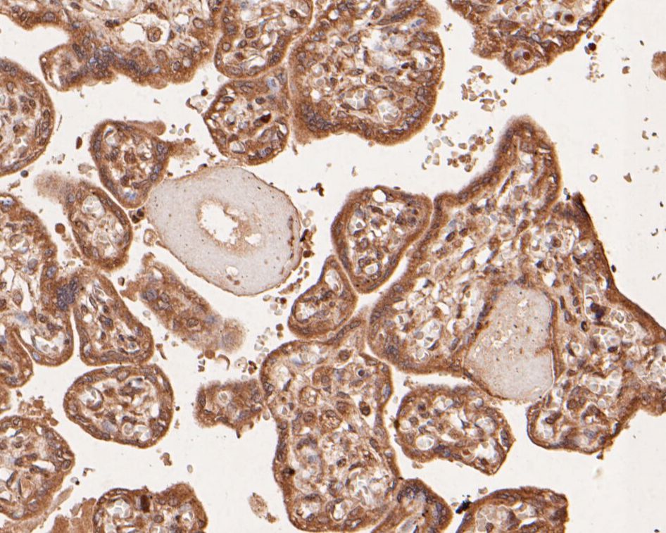 Fig8: Immunohistochemical analysis of paraffin-embedded human placenta tissue using anti-SPATA5L1 antibody. The section was pre-treated using heat mediated antigen retrieval with Tris-EDTA buffer (pH 8.0-8.4) for 20 minutes.The tissues were blocked in 5%