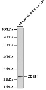 Western blot - CD151 Polyclonal Antibody 