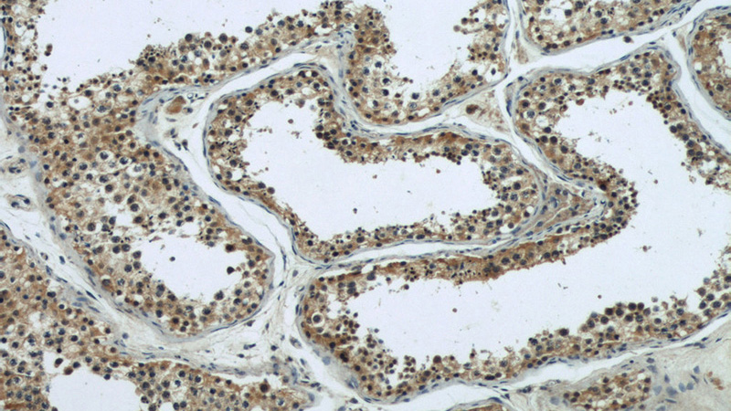 Immunohistochemical of paraffin-embedded human testis using Catalog No:108167(ARPC4 antibody) at dilution of 1:50 (under 10x lens)