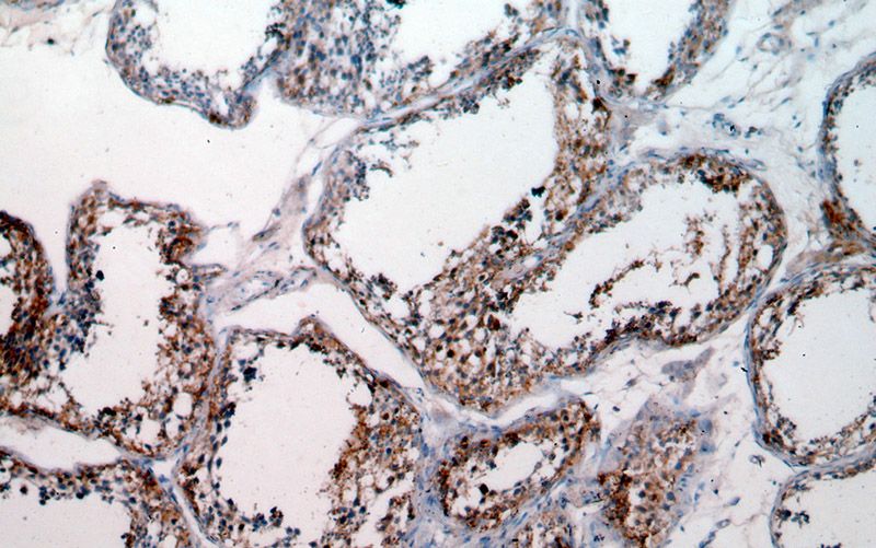 Immunohistochemical of paraffin-embedded human testis using Catalog No:108212(ASB17 antibody) at dilution of 1:50 (under 10x lens)