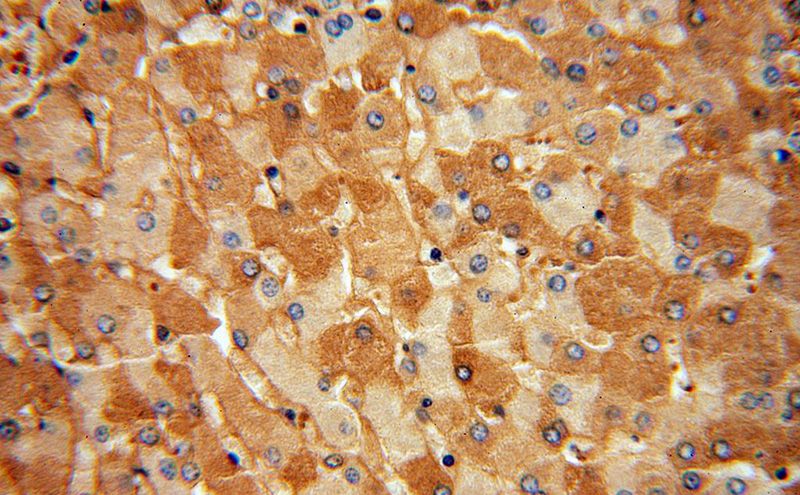 Immunohistochemical of paraffin-embedded human liver using Catalog No:107955(ALB antibody) at dilution of 1:100 (under 40x lens)