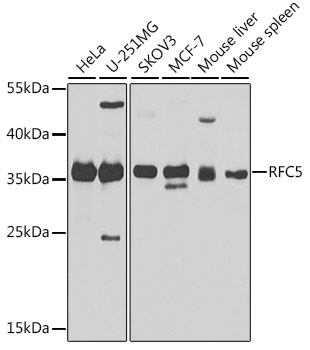 Western blot - RFC5 Polyclonal Antibody 