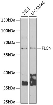 Western blot - FLCN Polyclonal Antibody 