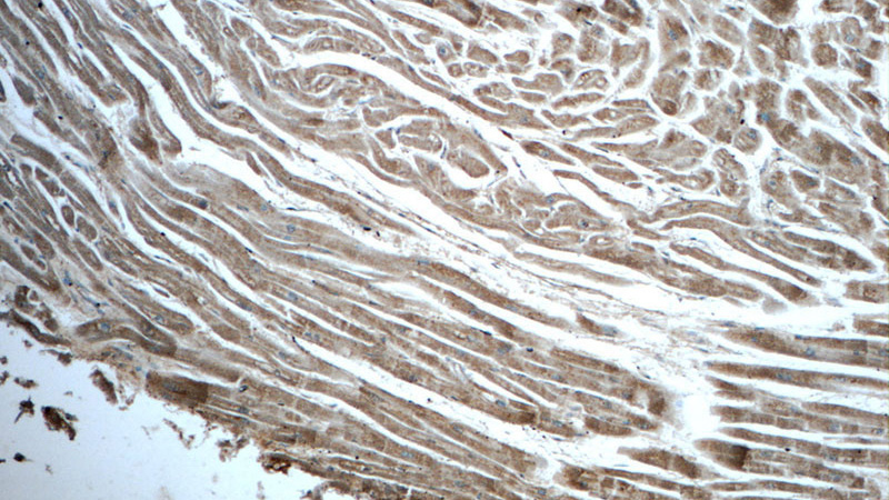 Immunohistochemistry of paraffin-embedded human heart tissue slide using Catalog No:109211(CHCHD10 Antibody) at dilution of 1:50 (under 10x lens)