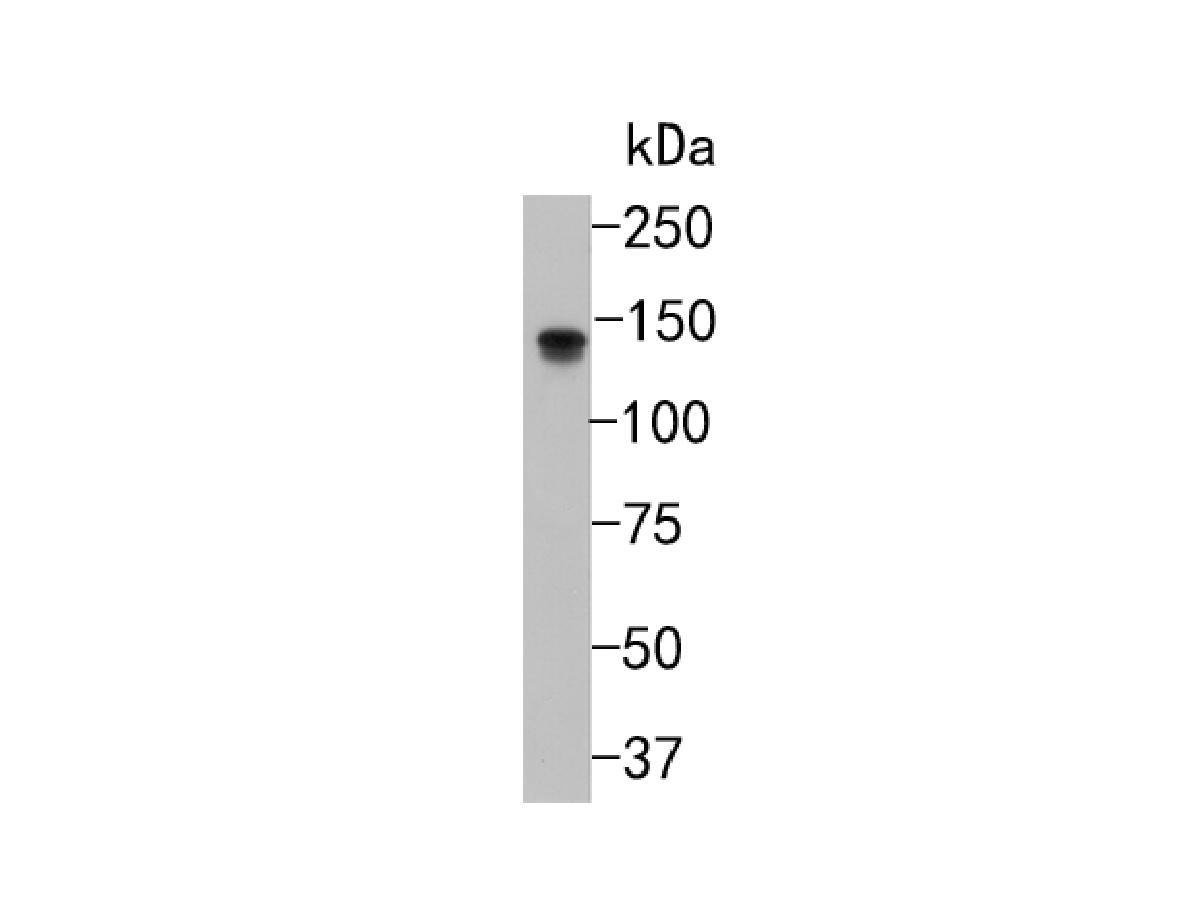 Fig2:; Western blot analysis of TrkA on N2A cell lysates. Proteins were transferred to a PVDF membrane and blocked with 5% BSA in PBS for 1 hour at room temperature. The primary antibody ( 1/500) was used in 5% BSA at room temperature for 2 hours. Goat Anti-Rabbit IgG - HRP Secondary Antibody (HA1001) at 1:200,000 dilution was used for 1 hour at room temperature.