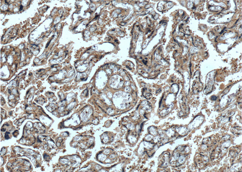 Immunohistochemistry of paraffin-embedded human placenta tissue slide using Catalog No:109270(CEP250,C-NAP1 Antibody) at dilution of 1:200 (under 10x lens).