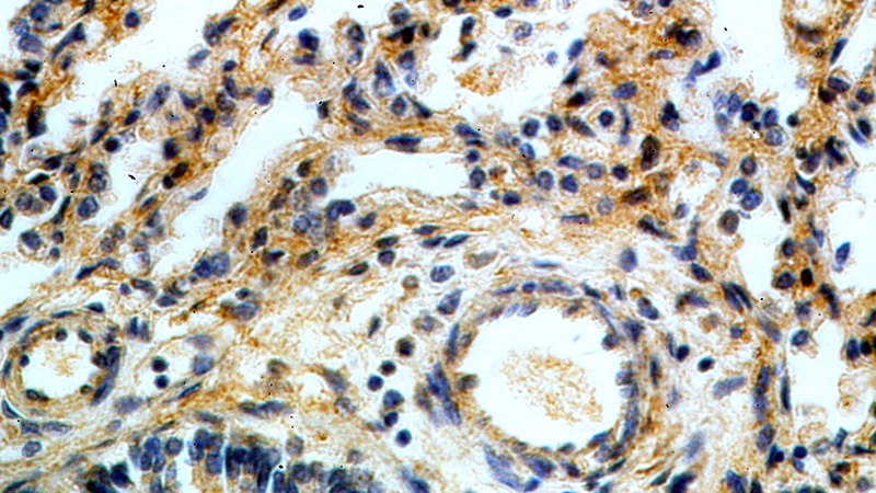 Immunohistochemical of paraffin-embedded human lung using Catalog No:116372(TSSC4 antibody) at dilution of 1:50 (under 40x lens)