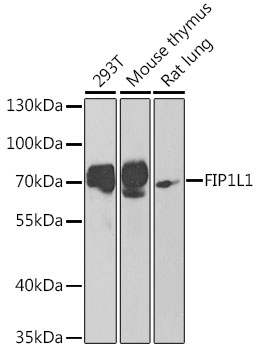 Western blot - FIP1L1 Polyclonal Antibody 