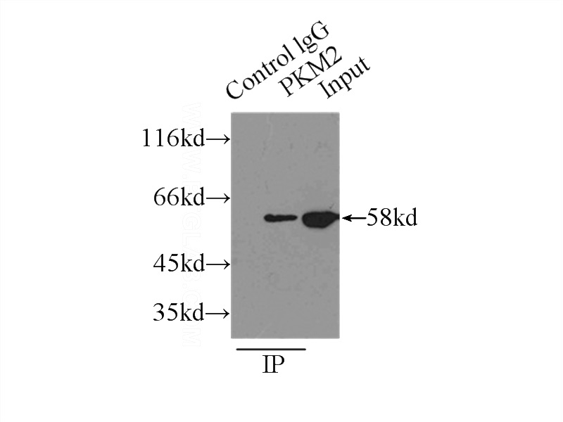 IP Result of anti-PK-M2-specific (IP:Catalog No:113861, 4ug; Detection:Catalog No:113861 1:300) with MCF-7 cells lysate 3250ug.