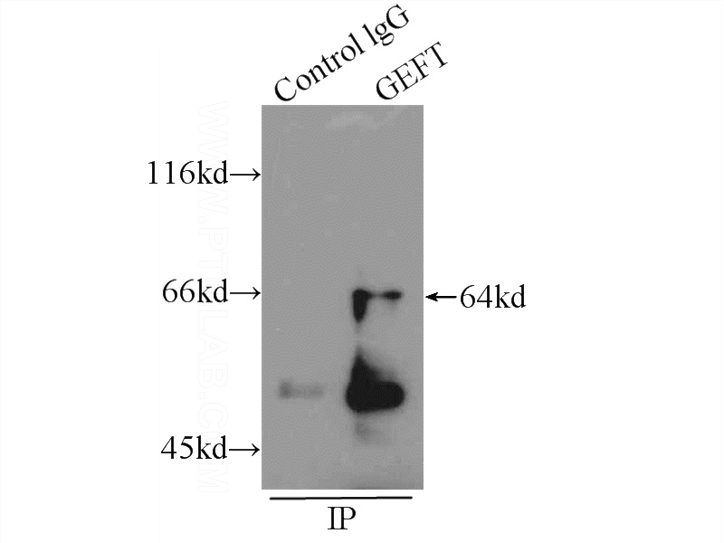 IP Result of anti-GEFT (IP:Catalog No:110934, 4ug; Detection:Catalog No:110934 1:400) with HEK-293 cells lysate 2000ug.