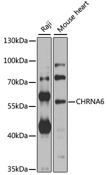 Western blot - CHRNA6 Polyclonal Antibody 