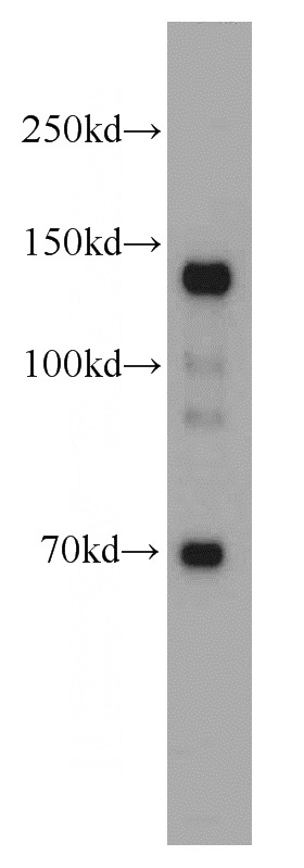 mouse brain tissue were subjected to SDS PAGE followed by western blot with Catalog No:113024(N-cadherin antibody) at dilution of 1:1000