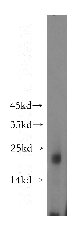 mouse liver tissue were subjected to SDS PAGE followed by western blot with Catalog No:110105(DNAJC15 antibody) at dilution of 1:1000