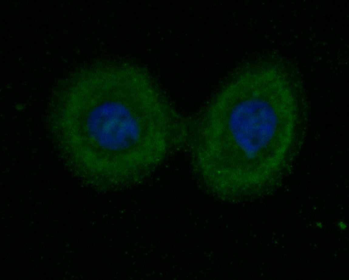 Fig2:; ICC staining of cGAS in A431 cells (green). Formalin fixed cells were permeabilized with 0.1% Triton X-100 in TBS for 10 minutes at room temperature and blocked with 1% Blocker BSA for 15 minutes at room temperature. Cells were probed with the primary antibody ( 1/100) for 1 hour at room temperature, washed with PBS. Alexa Fluor®488 Goat anti-Rabbit IgG was used as the secondary antibody at 1/1,000 dilution. The nuclear counter stain is DAPI (blue).