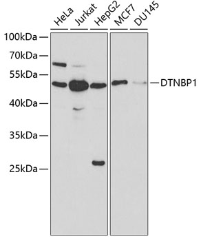 Western blot - DTNBP1 Polyclonal Antibody 