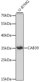 Western blot - CAB39 Polyclonal Antibody 