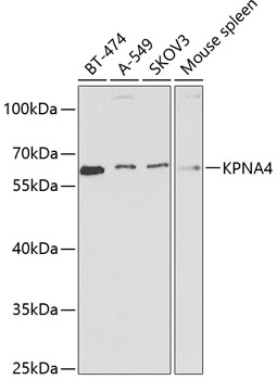 Western blot - KPNA4 Polyclonal Antibody 